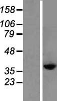 CysLT2 (CYSLTR2) Human Over-expression Lysate
