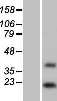 DOLPP1 Human Over-expression Lysate