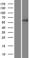 SMEK2 (PPP4R3B) Human Over-expression Lysate