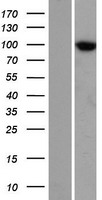 TTC7A Human Over-expression Lysate