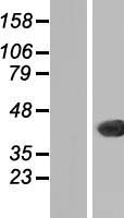 THAP11 Human Over-expression Lysate