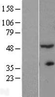 ACTR3B Human Over-expression Lysate