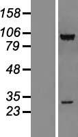 CSRP2BP (KAT14) Human Over-expression Lysate