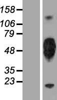 KIR2DL5A Human Over-expression Lysate