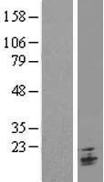 TMEM9B Human Over-expression Lysate