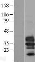 CLTRN Human Over-expression Lysate