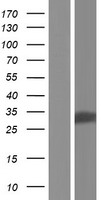 DECR2 Human Over-expression Lysate