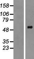 PPM1H Human Over-expression Lysate