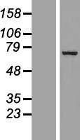 p66 beta (GATAD2B) Human Over-expression Lysate