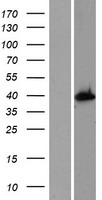 Cyt 19 (AS3MT) Human Over-expression Lysate