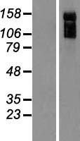 ARHGAP31 Human Over-expression Lysate