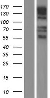 GPR158 Human Over-expression Lysate
