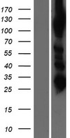 Alanyl tRNA synthetase 2 (AARS2) Human Over-expression Lysate