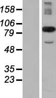 CCPG1 Human Over-expression Lysate