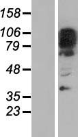 ZNF512B Human Over-expression Lysate