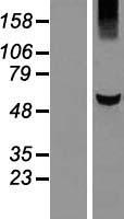 KLHDC5 (KLHL42) Human Over-expression Lysate