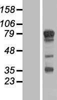 TBC1D14 Human Over-expression Lysate