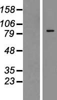 Zinc finger protein 287 (ZNF287) Human Over-expression Lysate