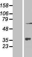 ZNF286 (ZNF286A) Human Over-expression Lysate