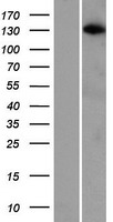 ARHGAP20 Human Over-expression Lysate
