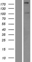 SIPA1L2 Human Over-expression Lysate