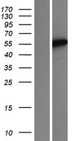 TRMT9B Human Over-expression Lysate