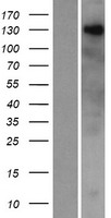 ZNF687 Human Over-expression Lysate