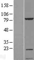 KIAA1530 (UVSSA) Human Over-expression Lysate