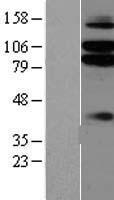 Netrin G1 ligand (LRRC4C) Human Over-expression Lysate