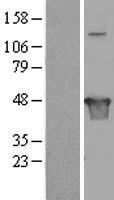 KIAA1576 (VAT1L) Human Over-expression Lysate