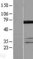 DDX55 Human Over-expression Lysate