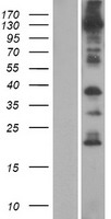 ANO8 Human Over-expression Lysate