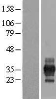RFPL1 Human Over-expression Lysate