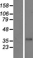 CFHR3 Human Over-expression Lysate