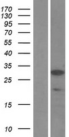 SSX5 Human Over-expression Lysate