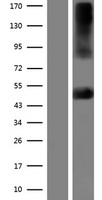 Kir2.2 (KCNJ12) Human Over-expression Lysate