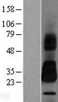 SPINT2 Human Over-expression Lysate