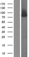 RNase L (RNASEL) Human Over-expression Lysate