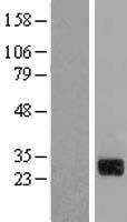 CTDSP1 Human Over-expression Lysate