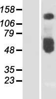 ZnT1 (SLC30A1) Human Over-expression Lysate