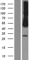 CADM3 Human Over-expression Lysate