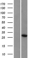 WRCH1 (RHOU) Human Over-expression Lysate