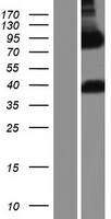 ARHGAP22 Human Over-expression Lysate