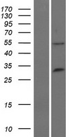 RNF21 (TRIM34) Human Over-expression Lysate