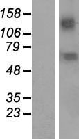KCNN2 Human Over-expression Lysate