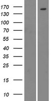 BCR Human Over-expression Lysate