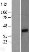 G protein beta 4 (GNB4) Human Over-expression Lysate