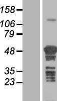 TSPYL4 Human Over-expression Lysate