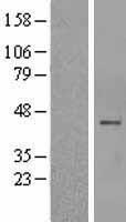 AMCase (CHIA) Human Over-expression Lysate