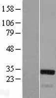 TGF beta induced factor 2 (TGIF2) Human Over-expression Lysate